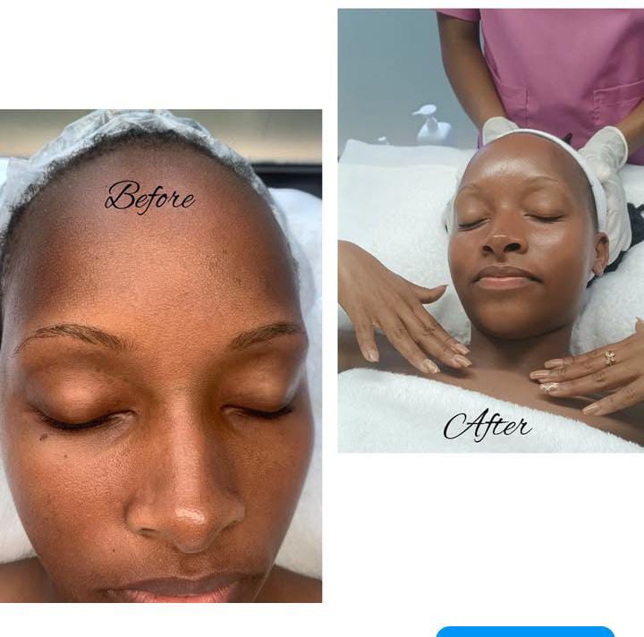 You are currently viewing Quench Your Skin’s Thirst: The Essential Guide to Hydrating Facials